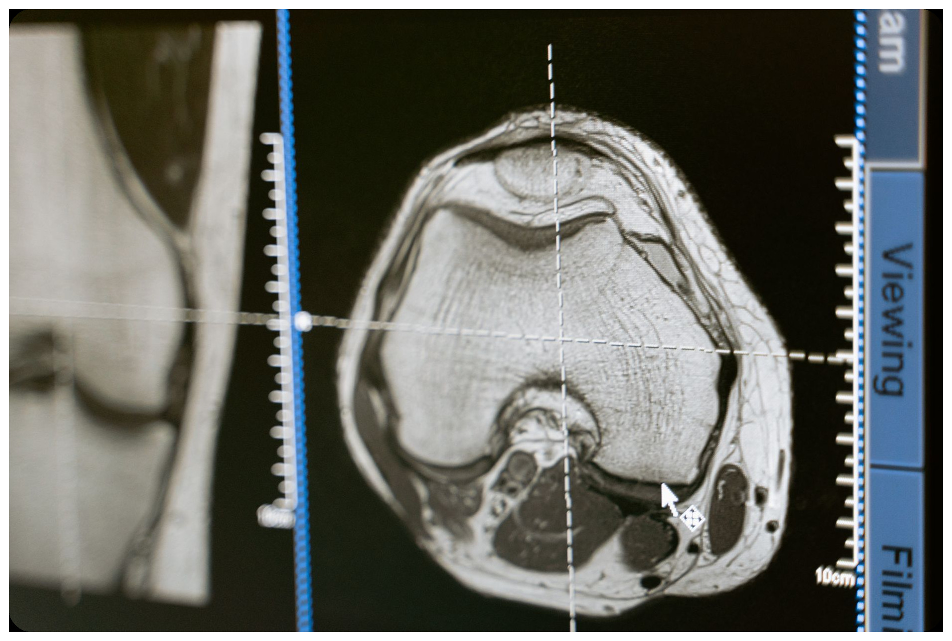 Forensic CT scanner examining metallic coffin containing rare corified mummy specimen, digital scan results showing brain hemorrhage analysis, scientific research equipment in modern laboratory